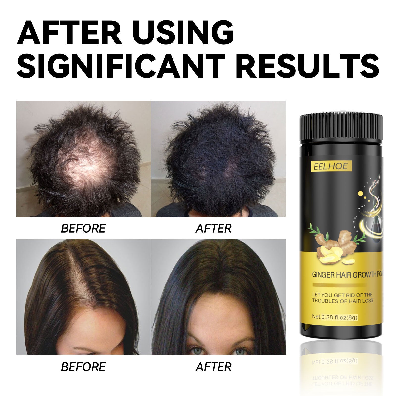 Keratin Hair Thickener for Thinning Hair for Men and Women, Create the Appearance of Fuller Hair